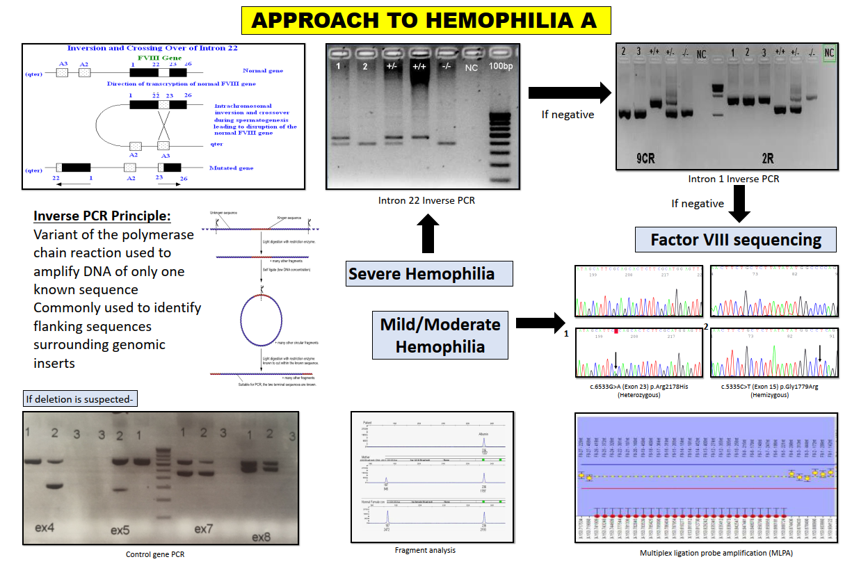 Approach to Hemophilia A