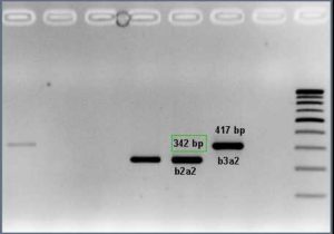 RT PCR BCR-ABL1/PML-RARA - CMC Haematology Molgen EQAS